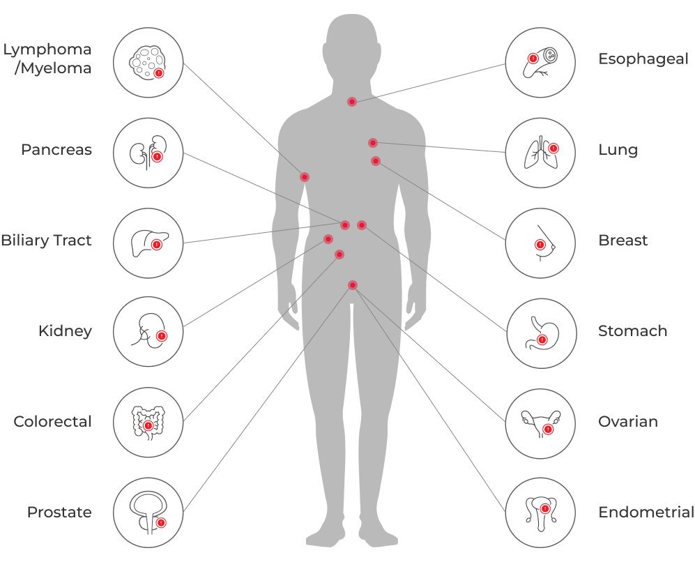 tumor types